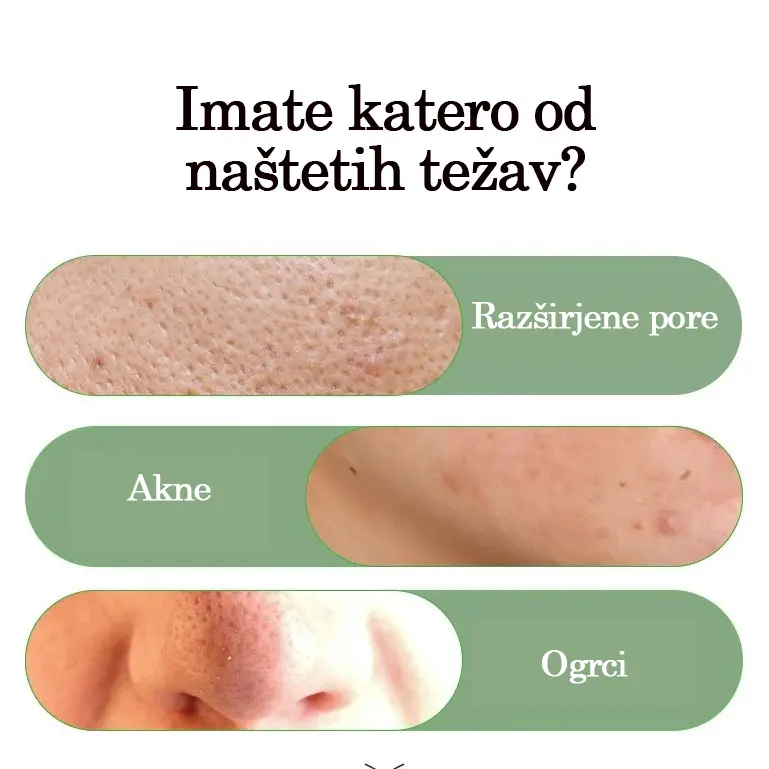Čistilna maska za obraz za vse tipe kože 2